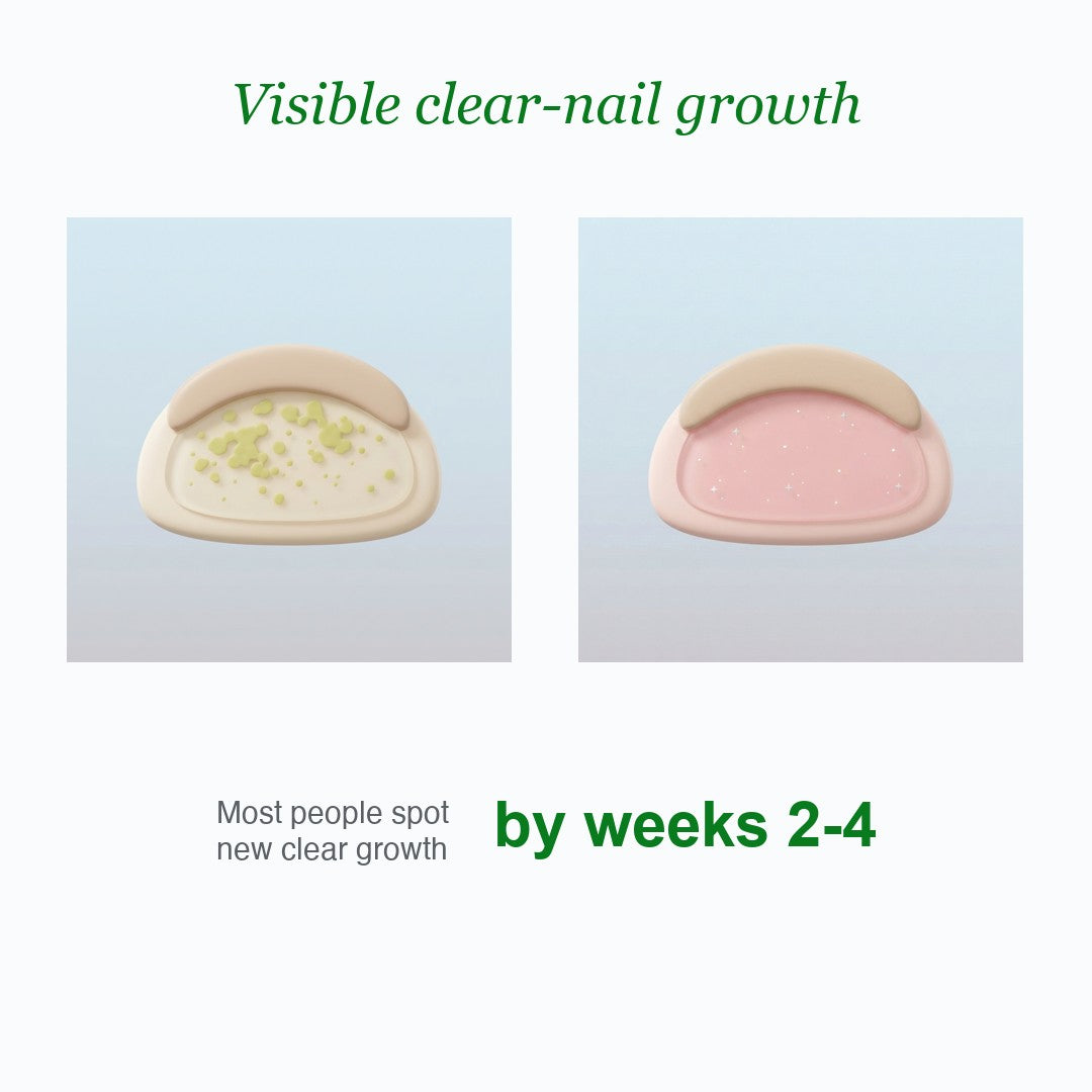 Infographic showing the nail bed clearing under the nail