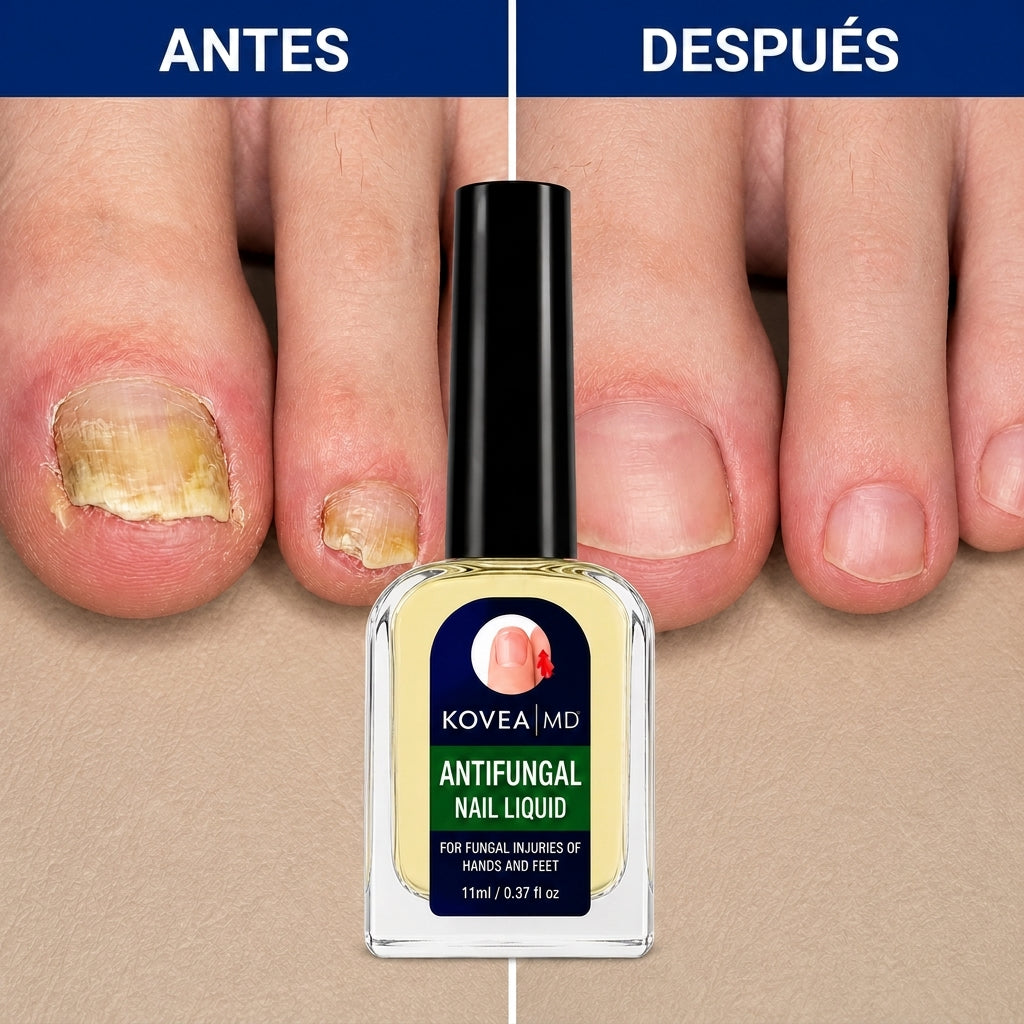 Antes y después uñas de los pies