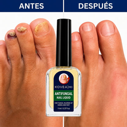 Antes y después uñas de los pies