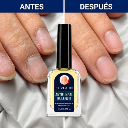 Antes y después uñas de las manos