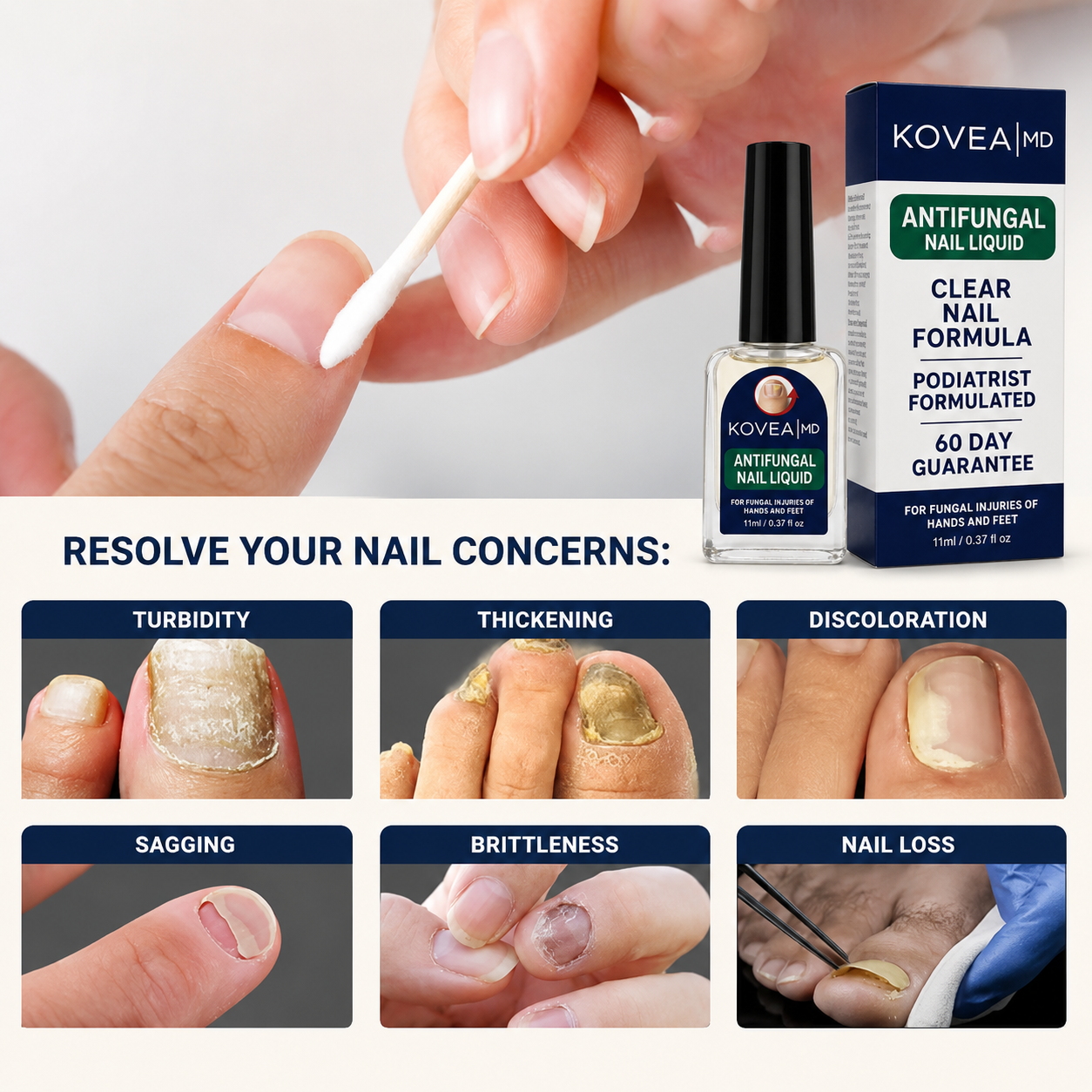 Clear Fungus Nails & Restore Healthy Clear Nails in Just 14 Days!