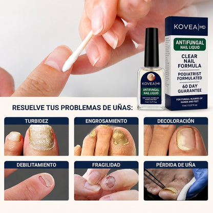 Problemas de uñas que resuelve Kovea